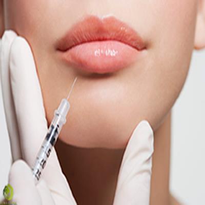 ✔️مزایای تزریق ژل لب مدل نچرال | 09190231250 دکتر مهسا یزدخواستی